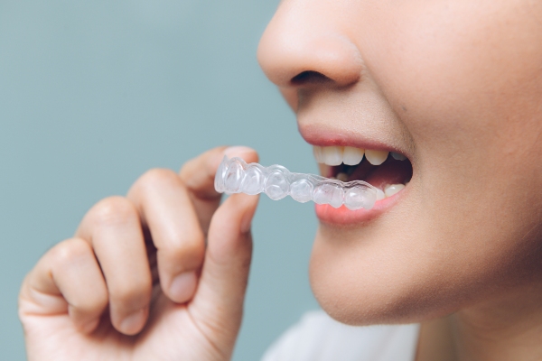 How Invisalign Can Straighten Teeth Fast